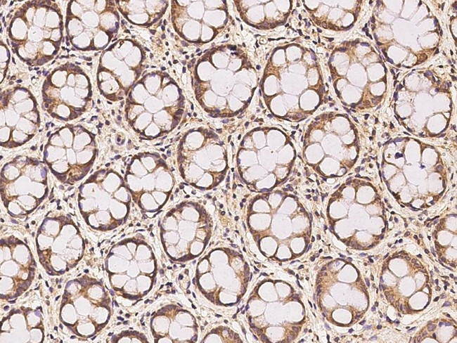 RDH14 Antibody in Immunohistochemistry (Paraffin) (IHC (P))