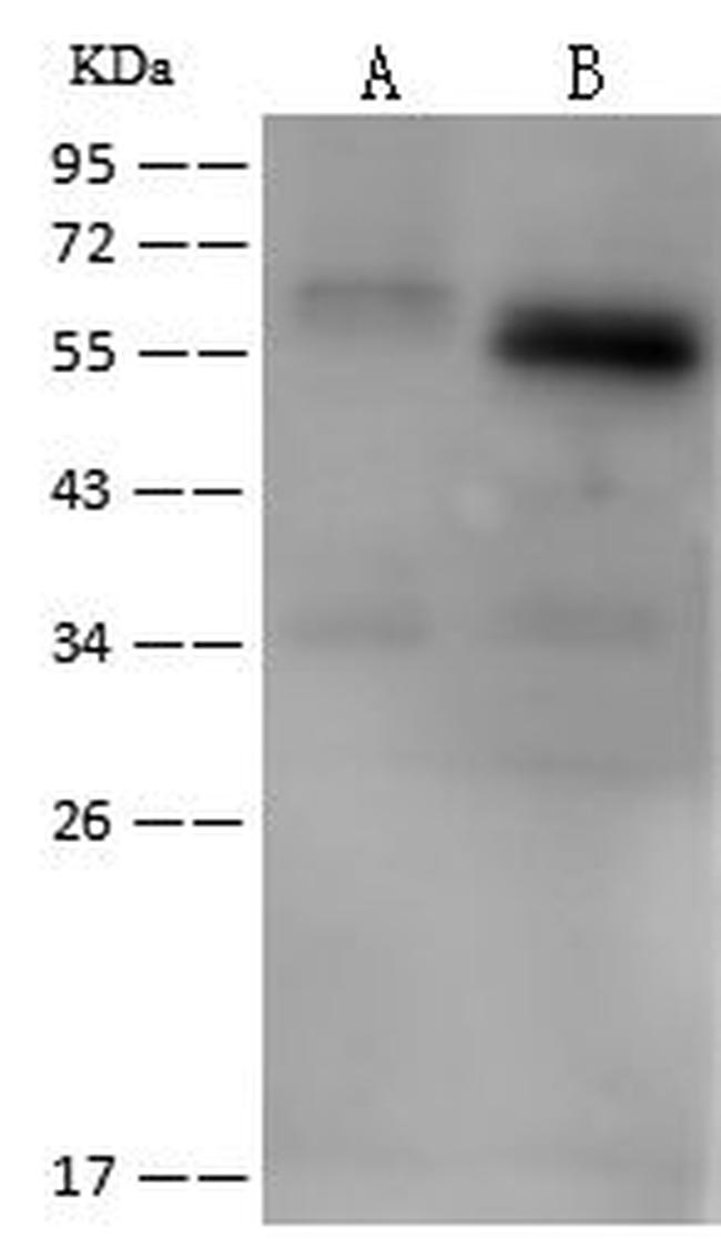 RGS7 Antibody in Western Blot (WB)
