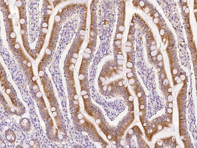 ROGDI Antibody in Immunohistochemistry (Paraffin) (IHC (P))