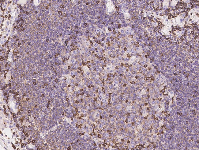 SH3KBP1 Antibody in Immunohistochemistry (Paraffin) (IHC (P))