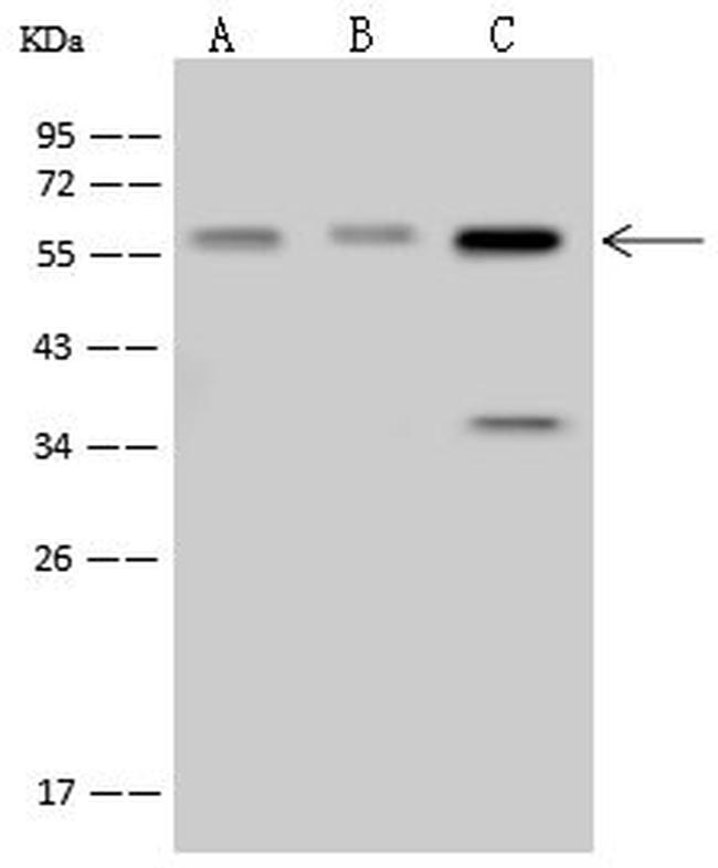 SMARCD1 Antibody in Western Blot (WB)