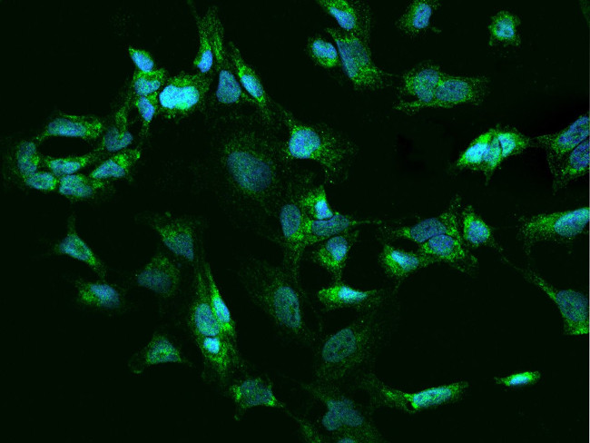 SMIM20 Antibody in Immunocytochemistry (ICC/IF)