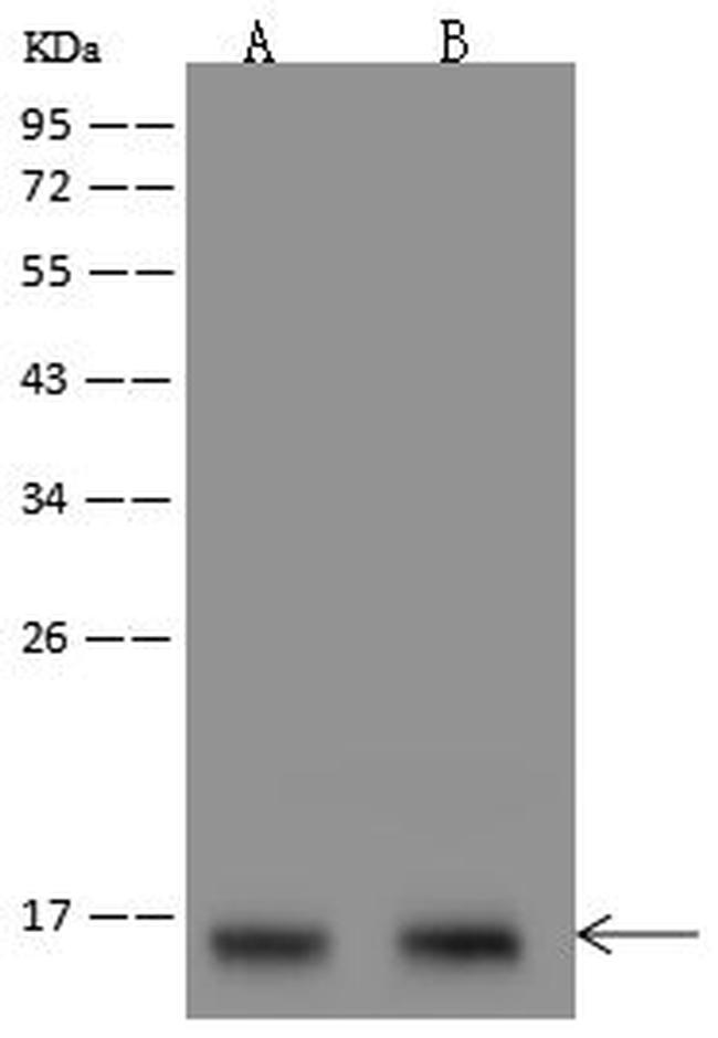 SNRPD1 Antibody in Western Blot (WB)