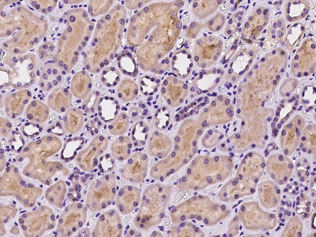 SNX8 Antibody in Immunohistochemistry (Paraffin) (IHC (P))