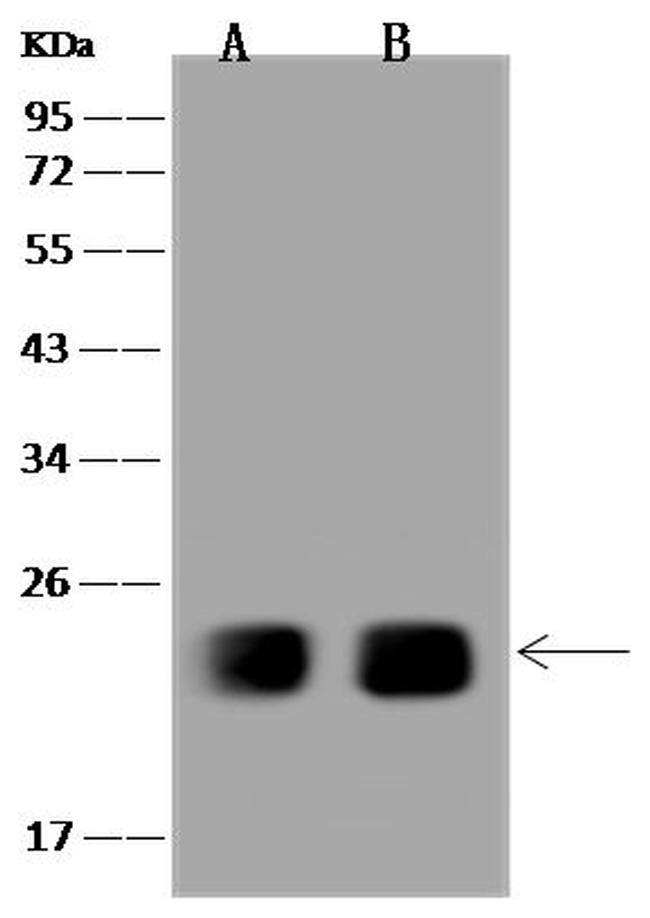 SPCS2 Antibody in Western Blot (WB)