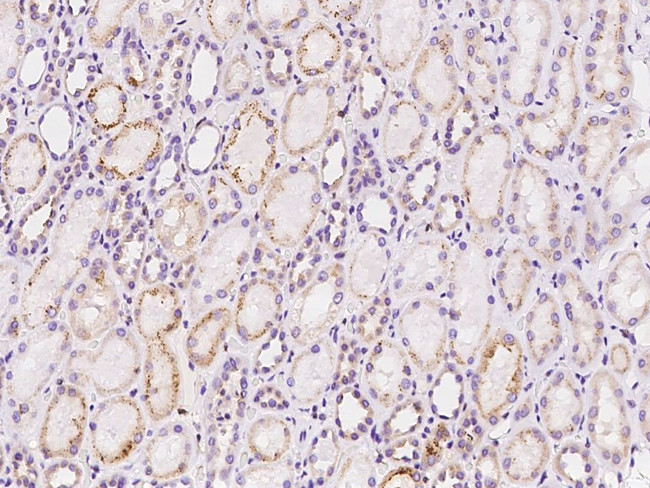 SRM Antibody in Immunohistochemistry (Paraffin) (IHC (P))