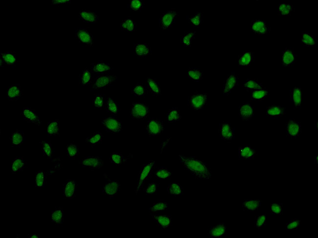 SRPK1 Antibody in Immunocytochemistry (ICC/IF)