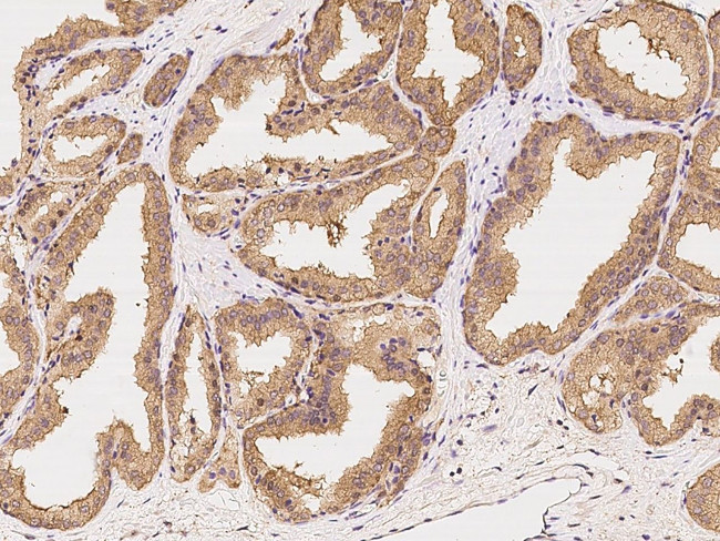 HIP Antibody in Immunohistochemistry (Paraffin) (IHC (P))