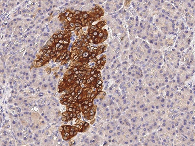 MUNC18 Antibody in Immunohistochemistry (Paraffin) (IHC (P))