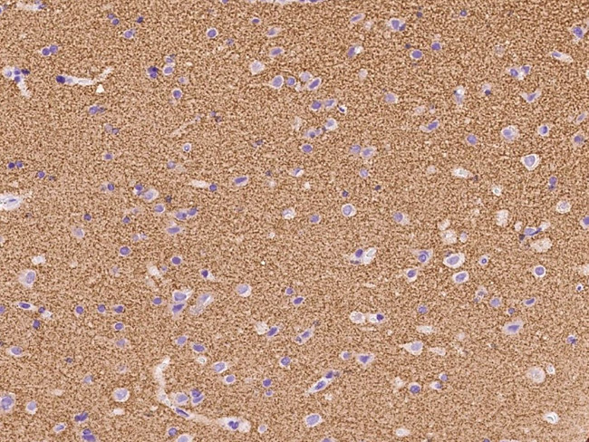 SYNGR1 Antibody in Immunohistochemistry (Paraffin) (IHC (P))
