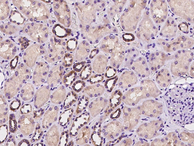 SYT12 Antibody in Immunohistochemistry (Paraffin) (IHC (P))