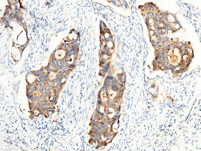 Transferrin Receptor Antibody in Immunohistochemistry (Paraffin) (IHC (P))