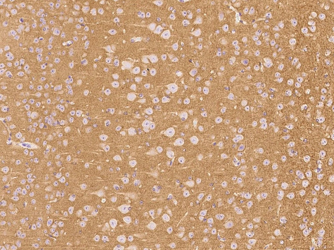 CD90 Antibody in Immunohistochemistry (Paraffin) (IHC (P))