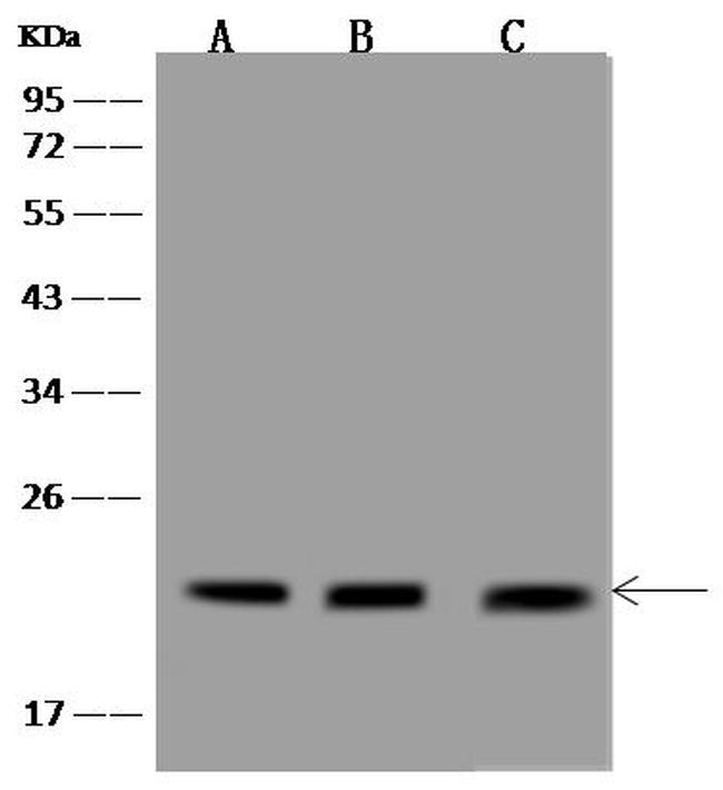TMEM199 Antibody in Western Blot (WB)