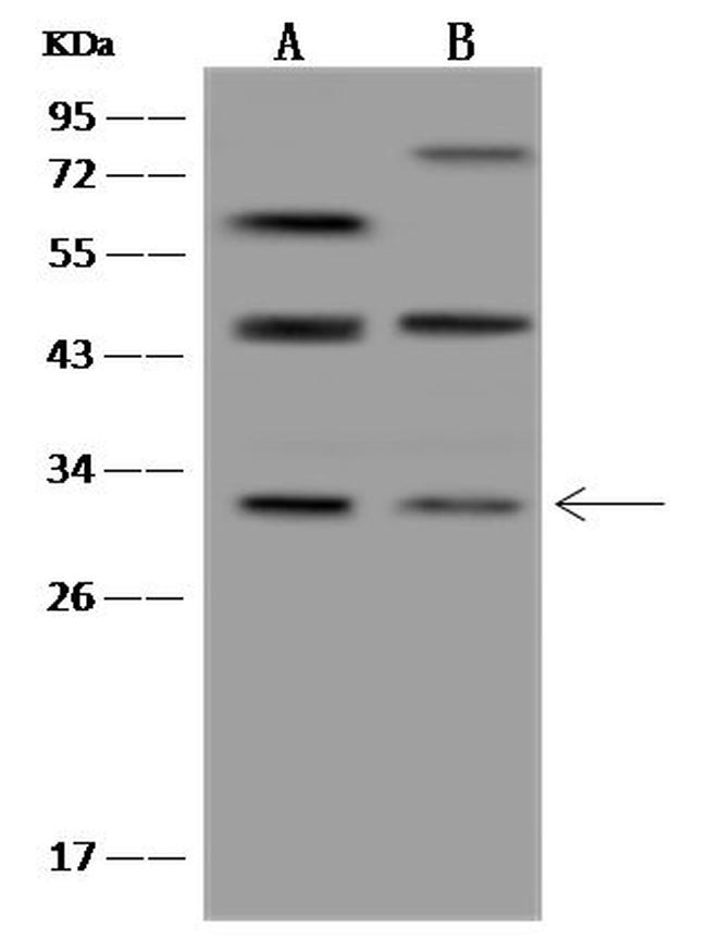 TMEM38B Antibody in Western Blot (WB)