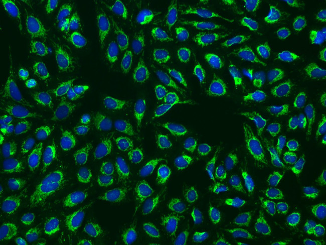 TOM70 Antibody in Immunocytochemistry (ICC/IF)