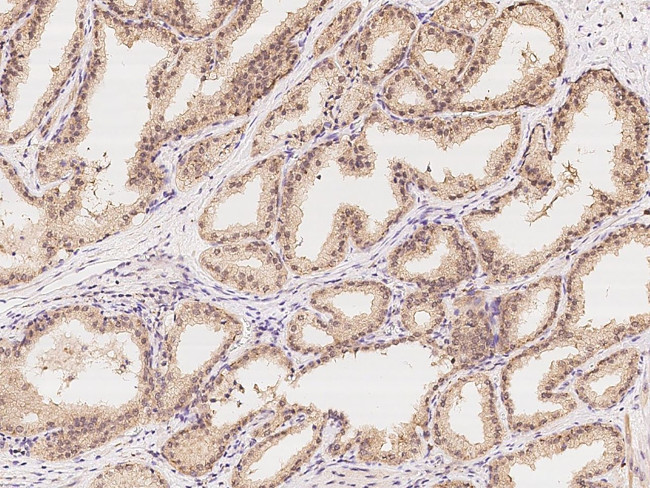 TTLL12 Antibody in Immunohistochemistry (Paraffin) (IHC (P))