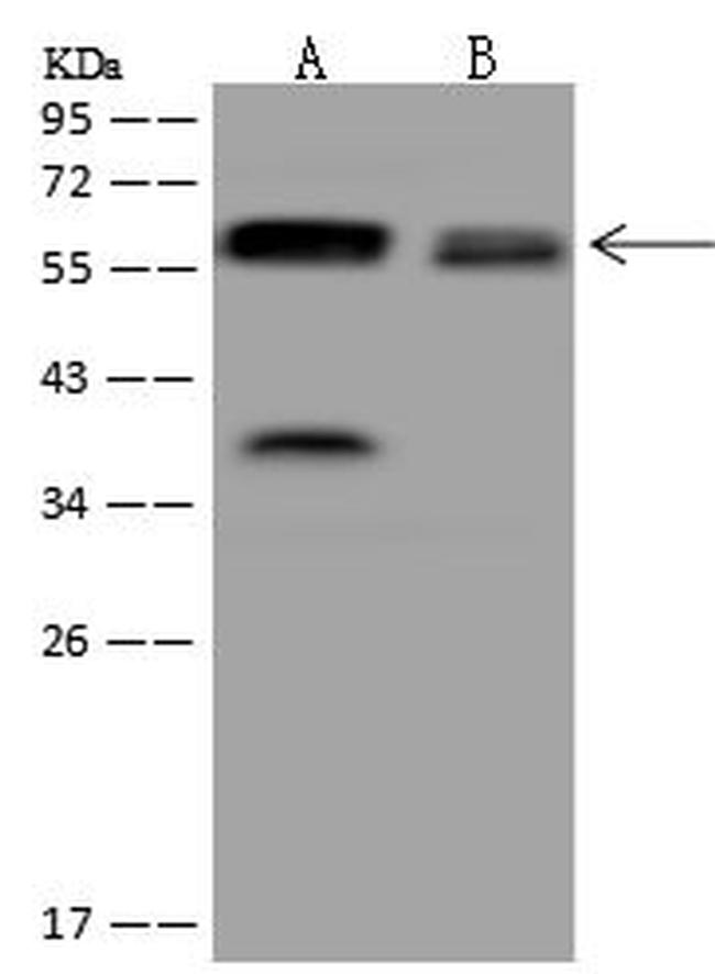 UGT8 Antibody in Western Blot (WB)
