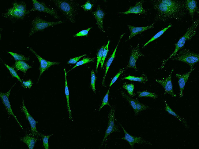 VAMP8 Antibody in Immunocytochemistry (ICC/IF)