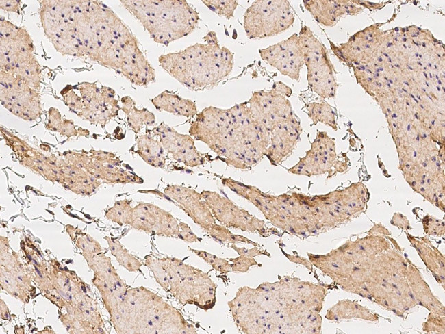 Vinculin Antibody in Immunohistochemistry (Paraffin) (IHC (P))