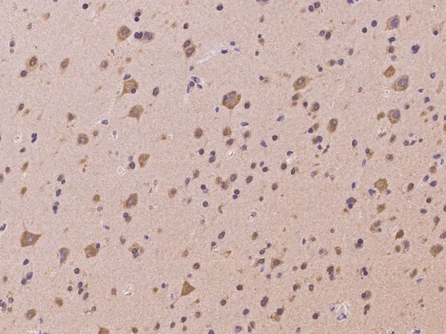 CCDC132 Antibody in Immunohistochemistry (Paraffin) (IHC (P))