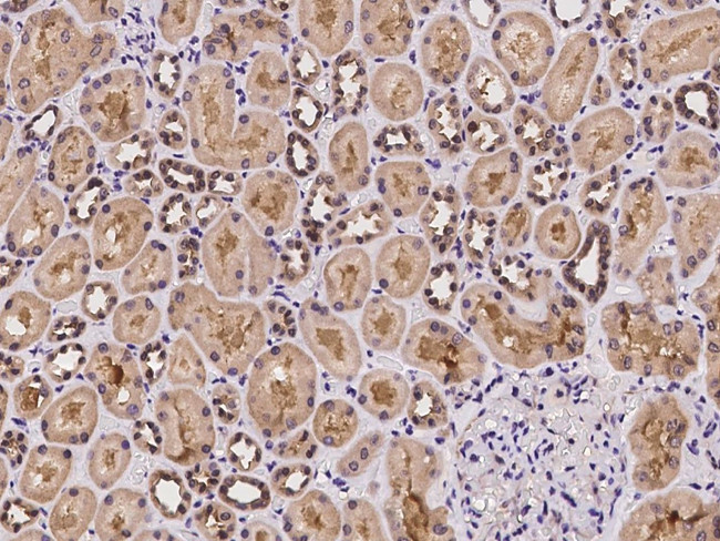 WDR77 Antibody in Immunohistochemistry (Paraffin) (IHC (P))