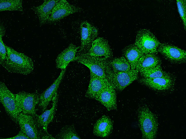 ZW10 Antibody in Immunocytochemistry (ICC/IF)