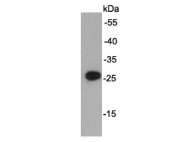 AU5 tag Antibody in Western Blot (WB)