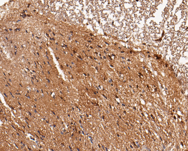 LGI1 Antibody in Immunohistochemistry (Paraffin) (IHC (P))