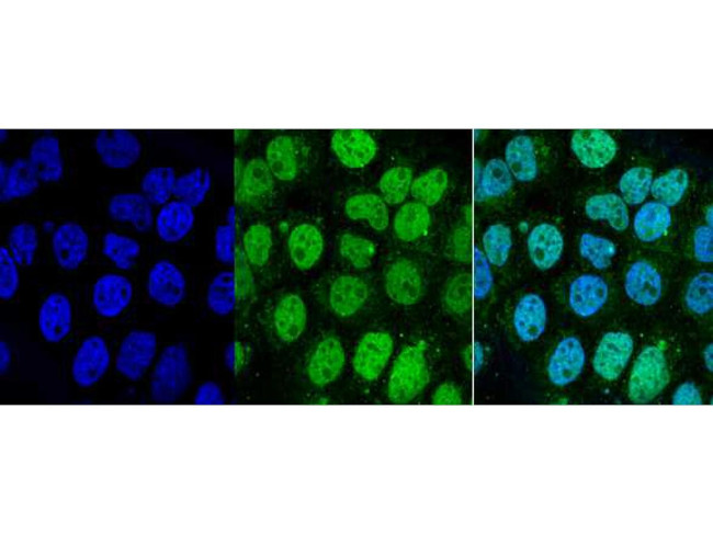 CHFR Antibody in Immunocytochemistry (ICC/IF)