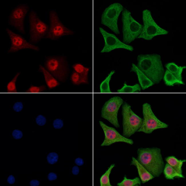 Phospho-RARA (Ser77) Antibody in Immunocytochemistry (ICC/IF)