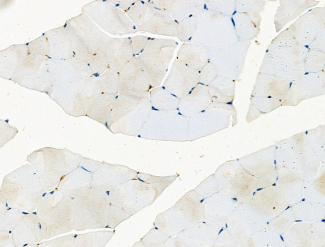 Phospho-EPS15 (Tyr849) Antibody in Immunohistochemistry (Paraffin) (IHC (P))