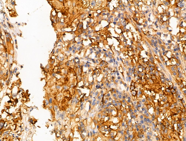 LZK Antibody in Immunohistochemistry (Paraffin) (IHC (P))