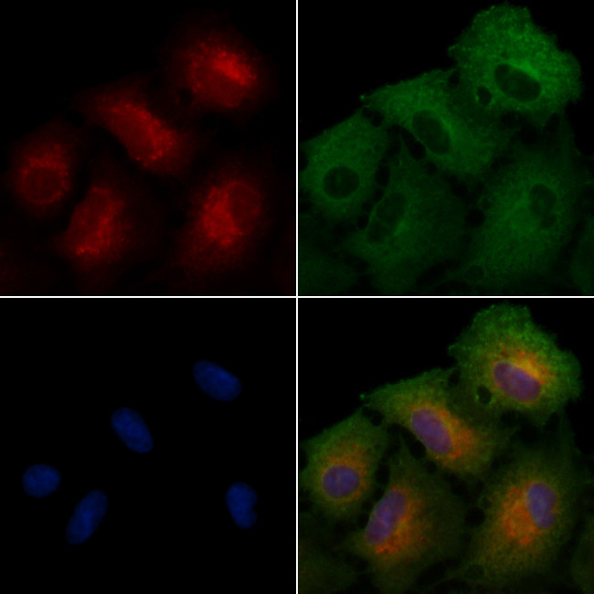 ILKAP Antibody in Immunocytochemistry (ICC/IF)