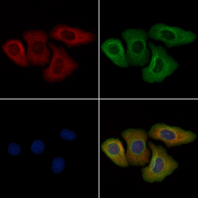 Phospho-ErbB2 (HER-2) (Tyr1221, Tyr1222) Antibody in Immunocytochemistry (ICC/IF)