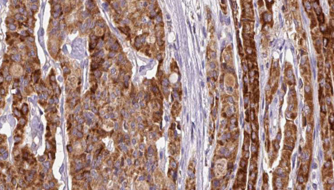 Phospho-PKMYT1 (Ser83) Antibody in Immunohistochemistry (Paraffin) (IHC (P))
