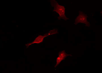 Phospho-TAK1 (Thr187) Antibody in Immunocytochemistry (ICC/IF)