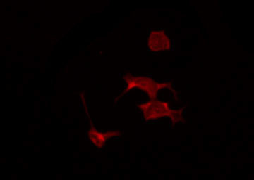 Phospho-Progesterone Receptor (Ser294) Antibody in Immunocytochemistry (ICC/IF)