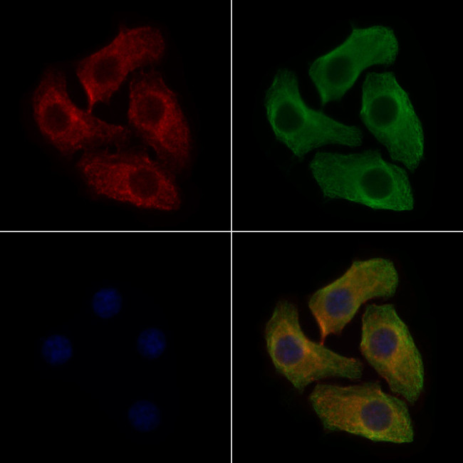 Phospho-IGF1R (Tyr1165, Tyr1166) Antibody in Immunocytochemistry (ICC/IF)