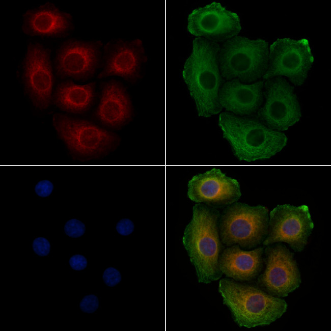 Phospho-BCR (Tyr360) Antibody in Immunocytochemistry (ICC/IF)