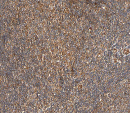 Phospho-PLCG2 (Tyr753) Antibody in Immunohistochemistry (Paraffin) (IHC (P))