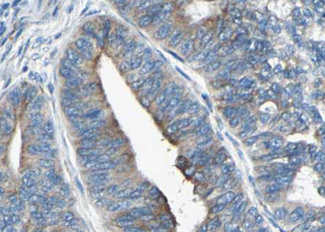 Phospho-Synaptotagmin 1/2 (Thr202) Antibody in Immunohistochemistry (Paraffin) (IHC (P))