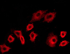 Phospho-PI3K p85/p55 (Tyr467, Tyr199) Antibody in Immunocytochemistry (ICC/IF)
