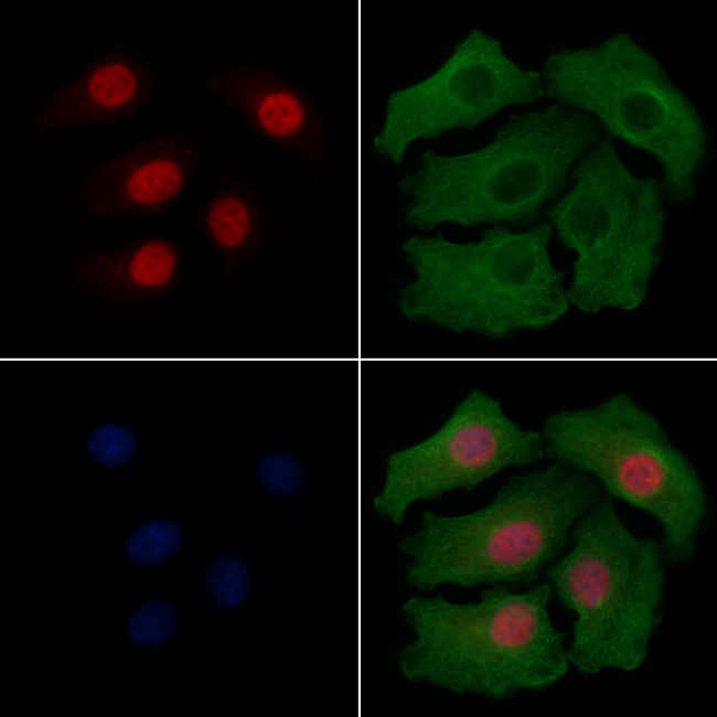 Phospho-CHOP (Ser30) Antibody in Immunocytochemistry (ICC/IF)