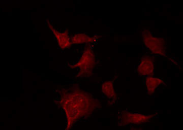 Phospho-Caspase 3 (Ser150) Antibody in Immunocytochemistry (ICC/IF)
