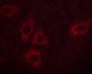 Phospho-Calmodulin 1/2/3 (Thr79, Ser81) Antibody in Immunocytochemistry (ICC/IF)