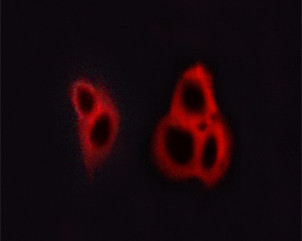Phospho-NMDAR1 (Ser890) Antibody in Immunocytochemistry (ICC/IF)