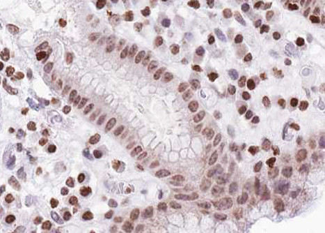 Phospho-FOXO1/FOXO3/FOXO4 (Thr24, Thr32) Antibody in Immunohistochemistry (Paraffin) (IHC (P))