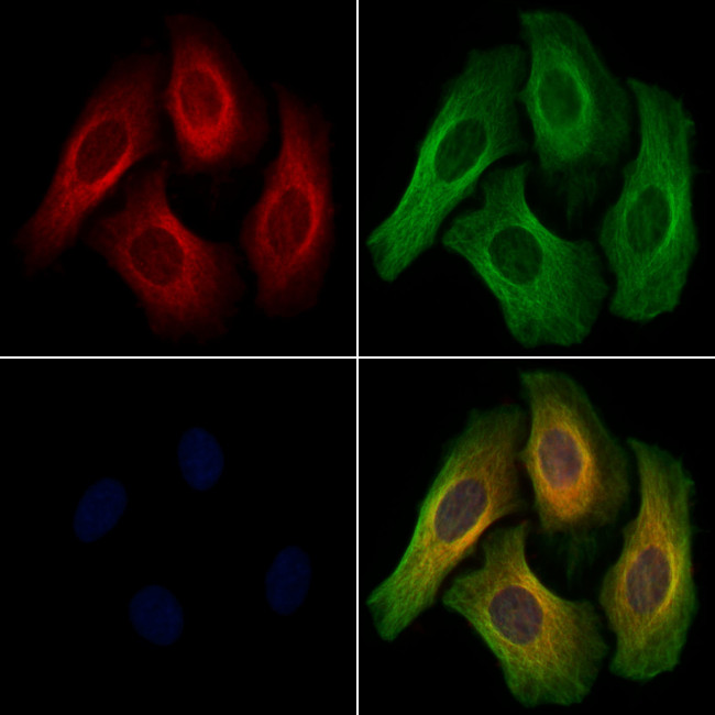 Phospho-PKC mu (Tyr463) Antibody in Immunocytochemistry (ICC/IF)