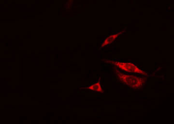 Phospho-PKD1/2/3/PKC mu (Ser738, Ser742) Antibody in Immunocytochemistry (ICC/IF)